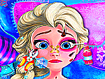 Blessures d'Elsa la reine des neiges